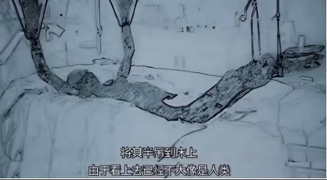 工人大内久因操作失误,遭受超20000倍正常剂量的核辐射