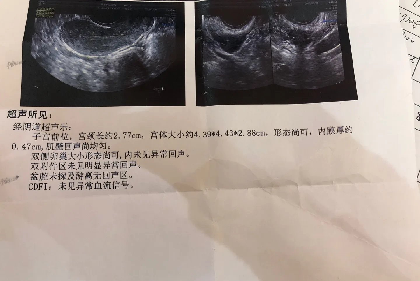 报告图片子宫内膜薄的彩超图片子宫三线征明显比超单子怀孕图片彩超