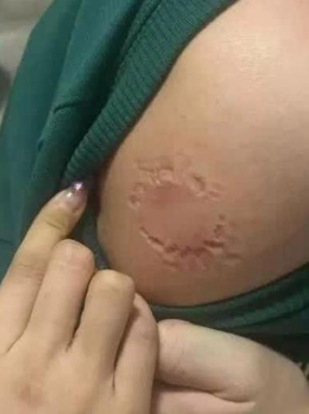 在公司闲的无聊跟同事们开玩笑,忽然有一个女同事上来就把我的胳膊咬