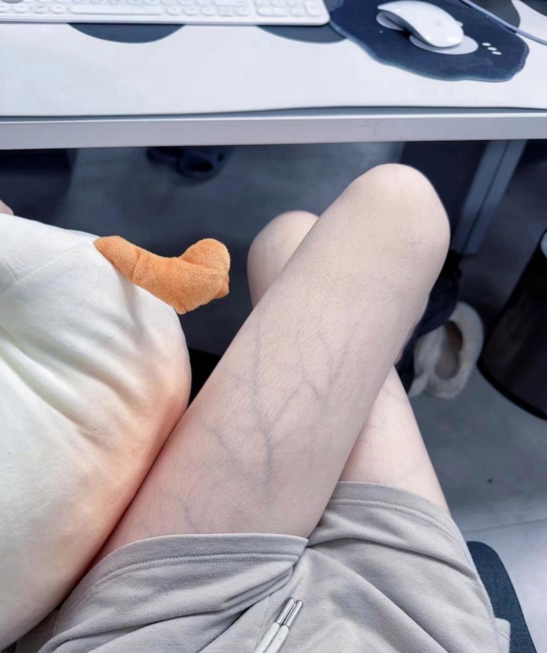 公司前几天招了一个女的,瘦不拉几的,腿上还有这么多青筋,还好意思穿