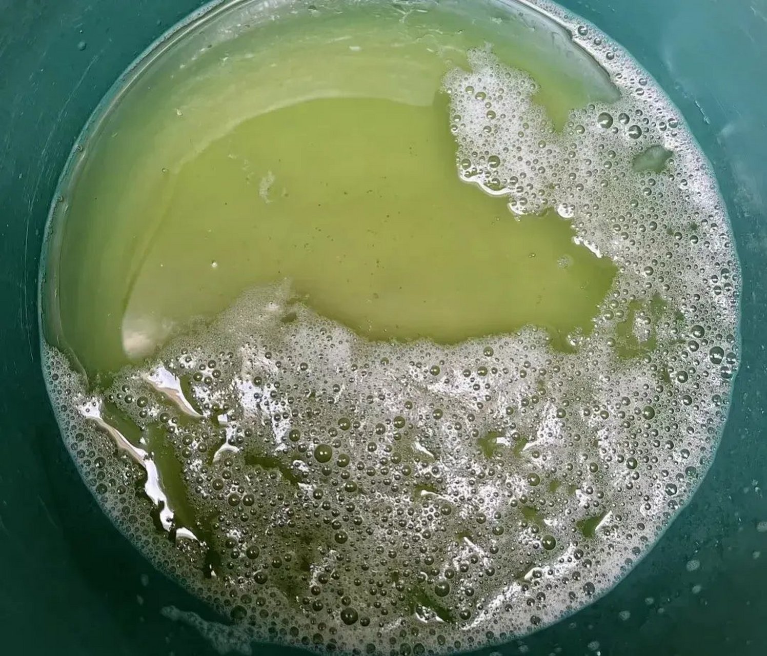 半个月,泡沫尿全消了  53岁胡先生在一次小便后忽然发现自己尿里泡沫