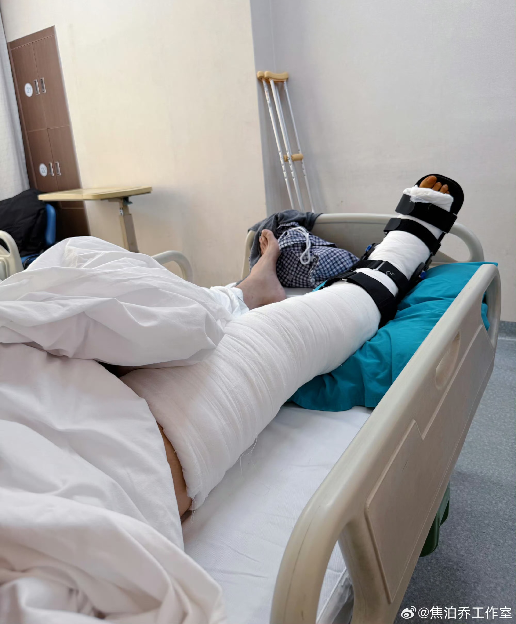 的伤病情况: 昨天下午焦泊乔已顺利完成手术,但此次受伤程度超出预期