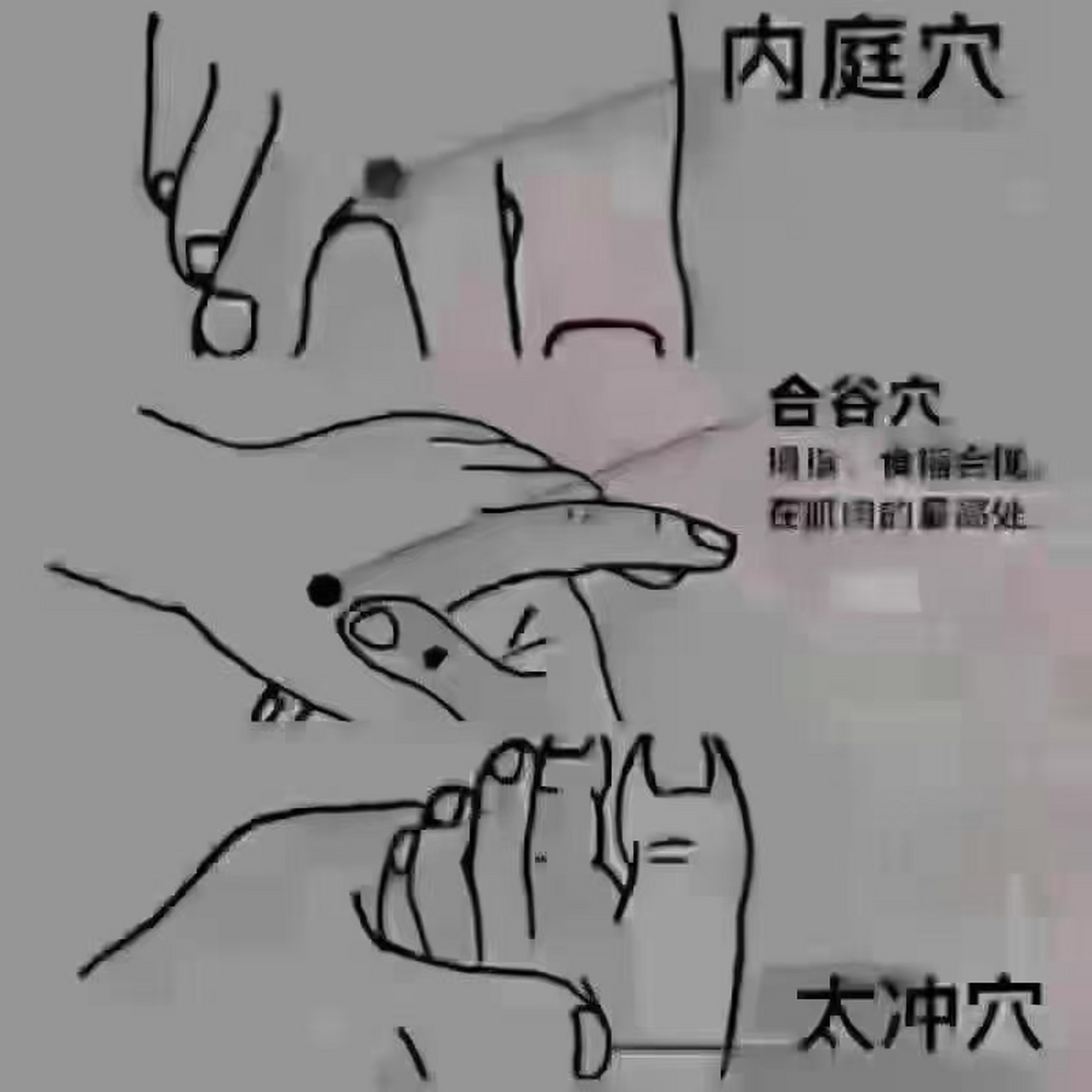 三大去火要穴 1,合谷去肺火 2,太冲去肝火 3,内庭去胃火 是药三分毒!