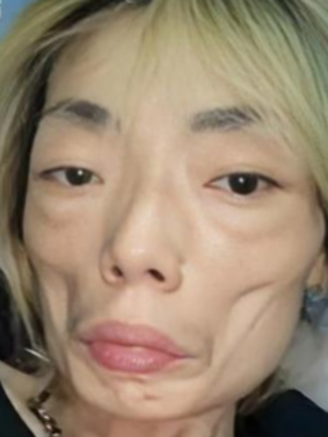 婚后被嫌胖,伍智恒疯狂减肥,患上肠胃病切除大部分胃部,体重一度只剩