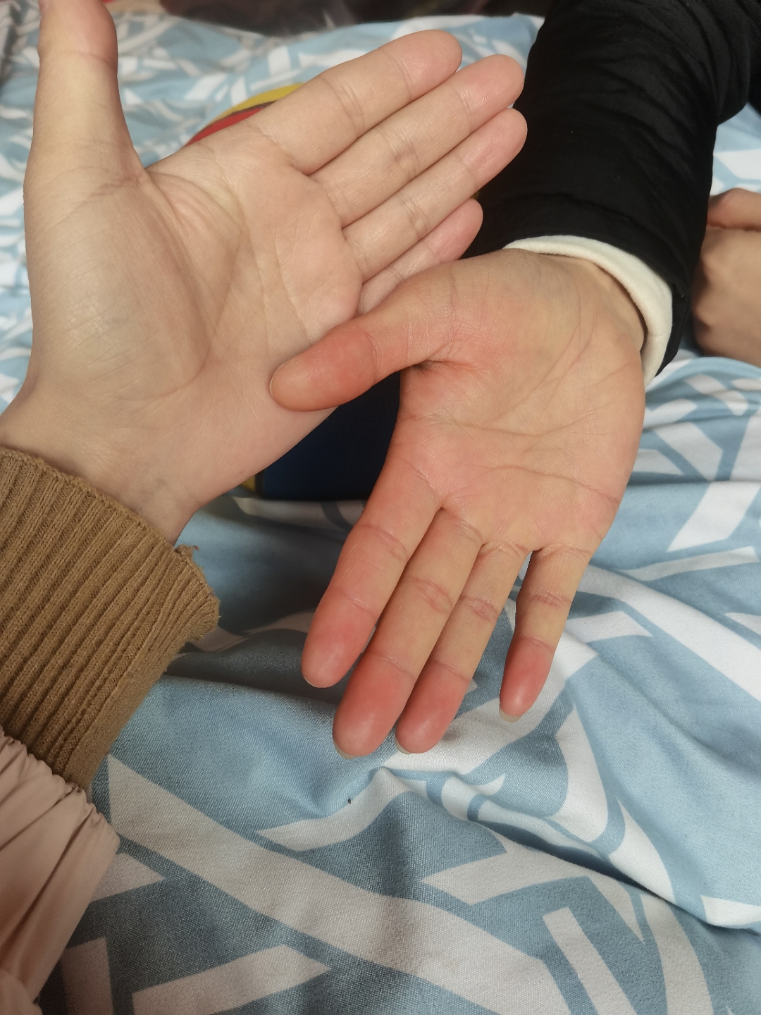 有没有学医的亲亲 回到家里看到姐姐的手特别的黄,这是怎么回事呀