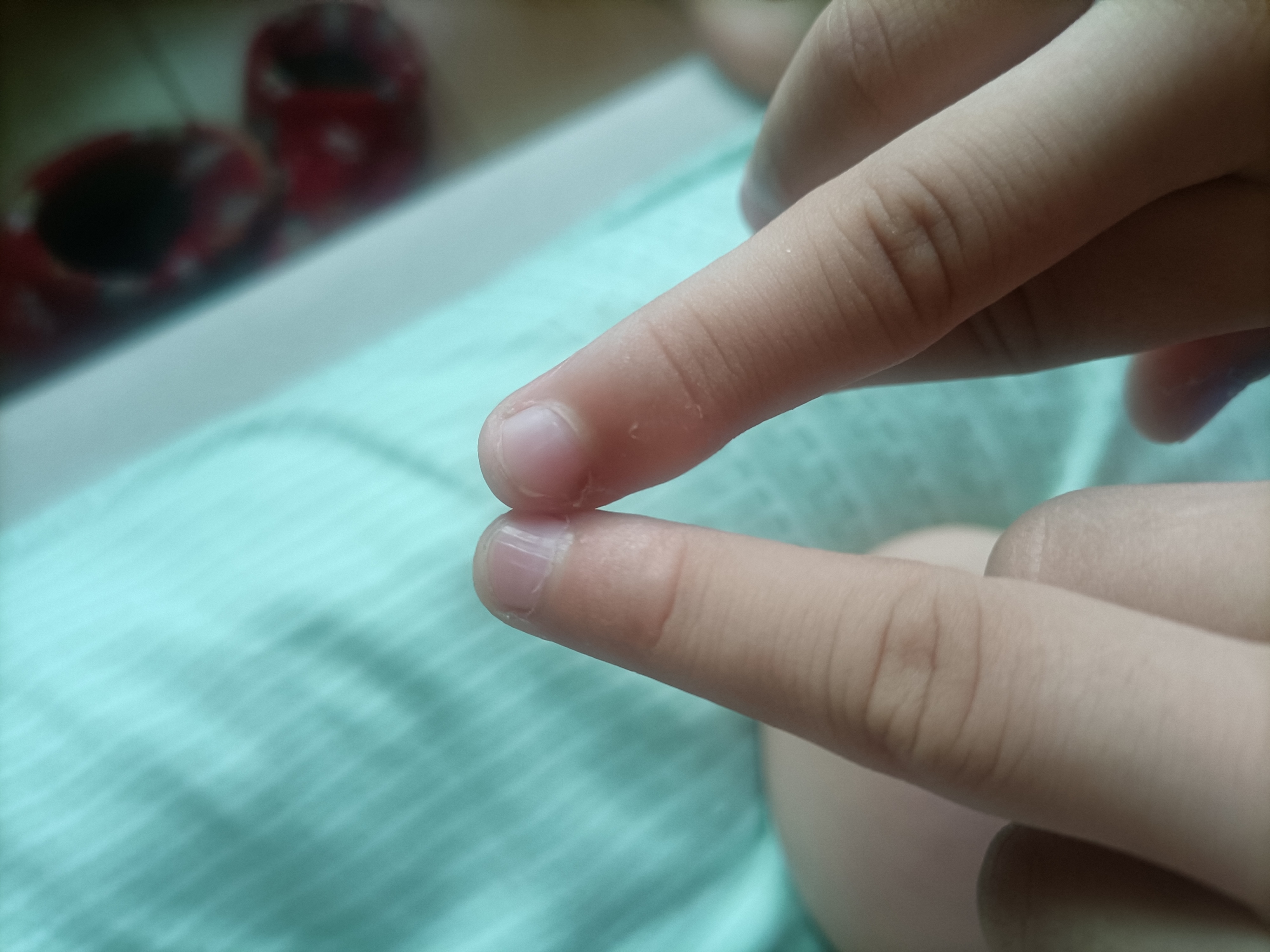 九岁的小孩子,两个中指不一样,有一个中指就突出了一块,有没有网友