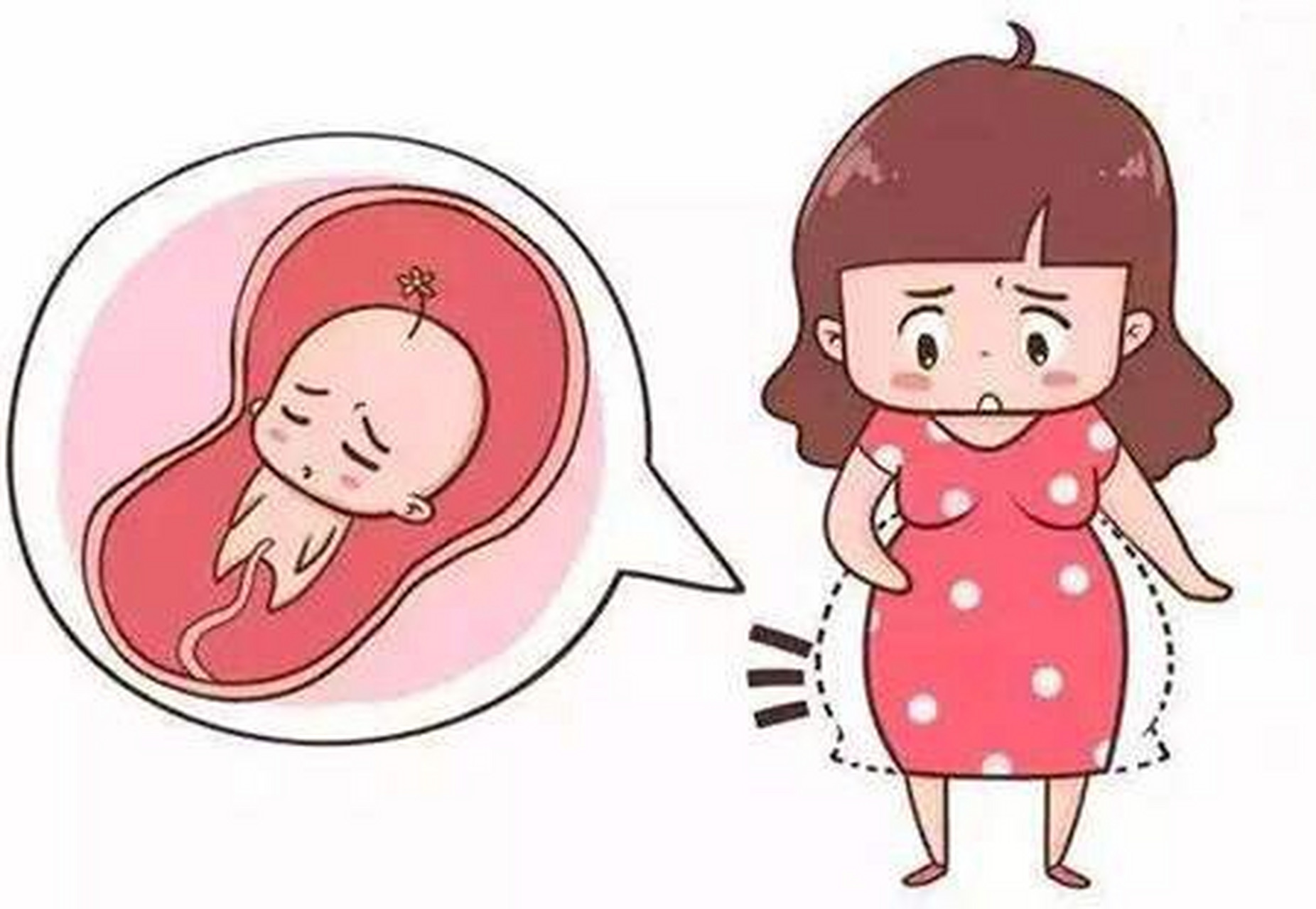 宝宝胎记##黑色胎记##上海##上海胎记##婴儿胎记是由皮肤色素异常或