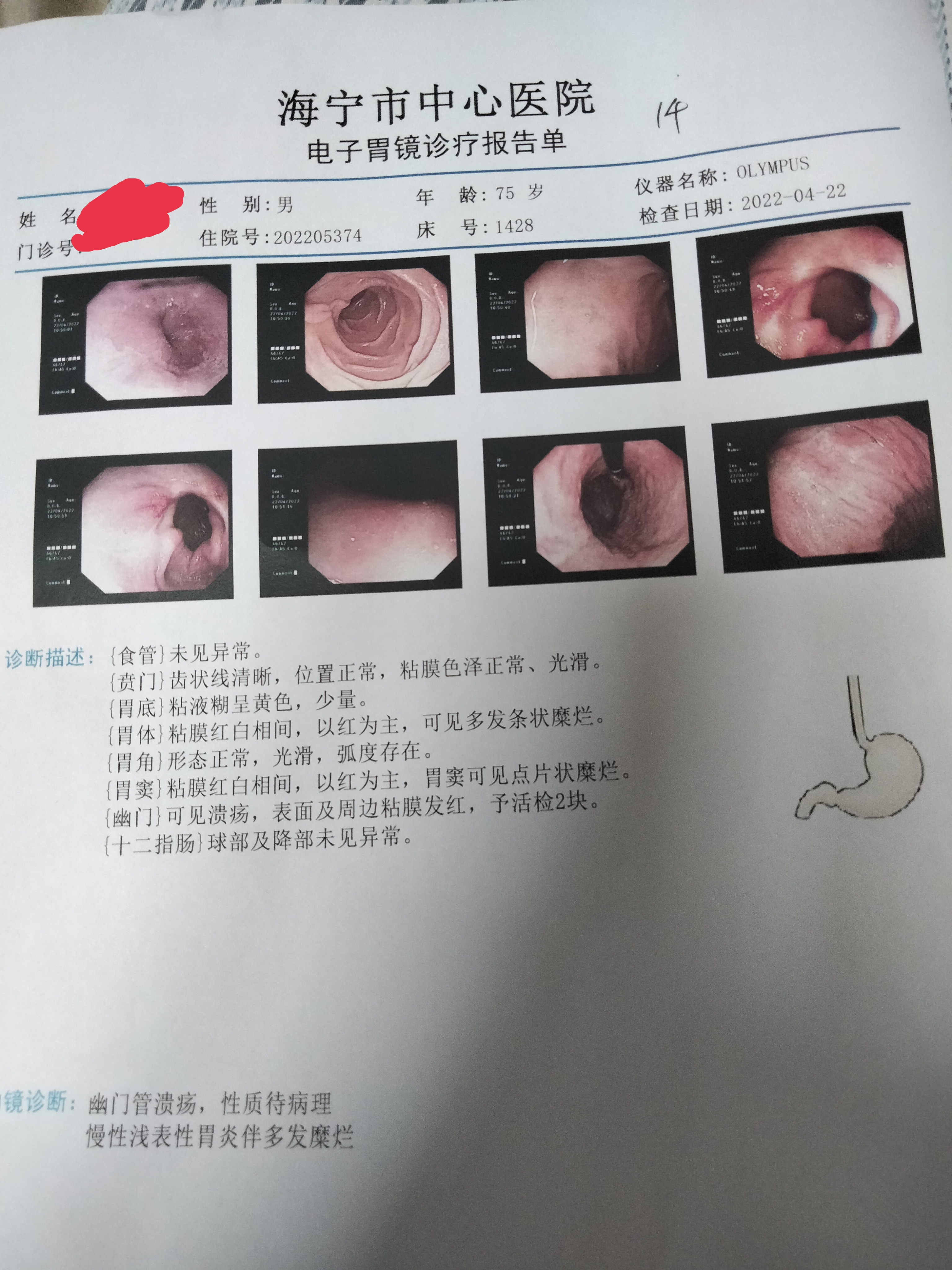 胃出血化验单图片图片