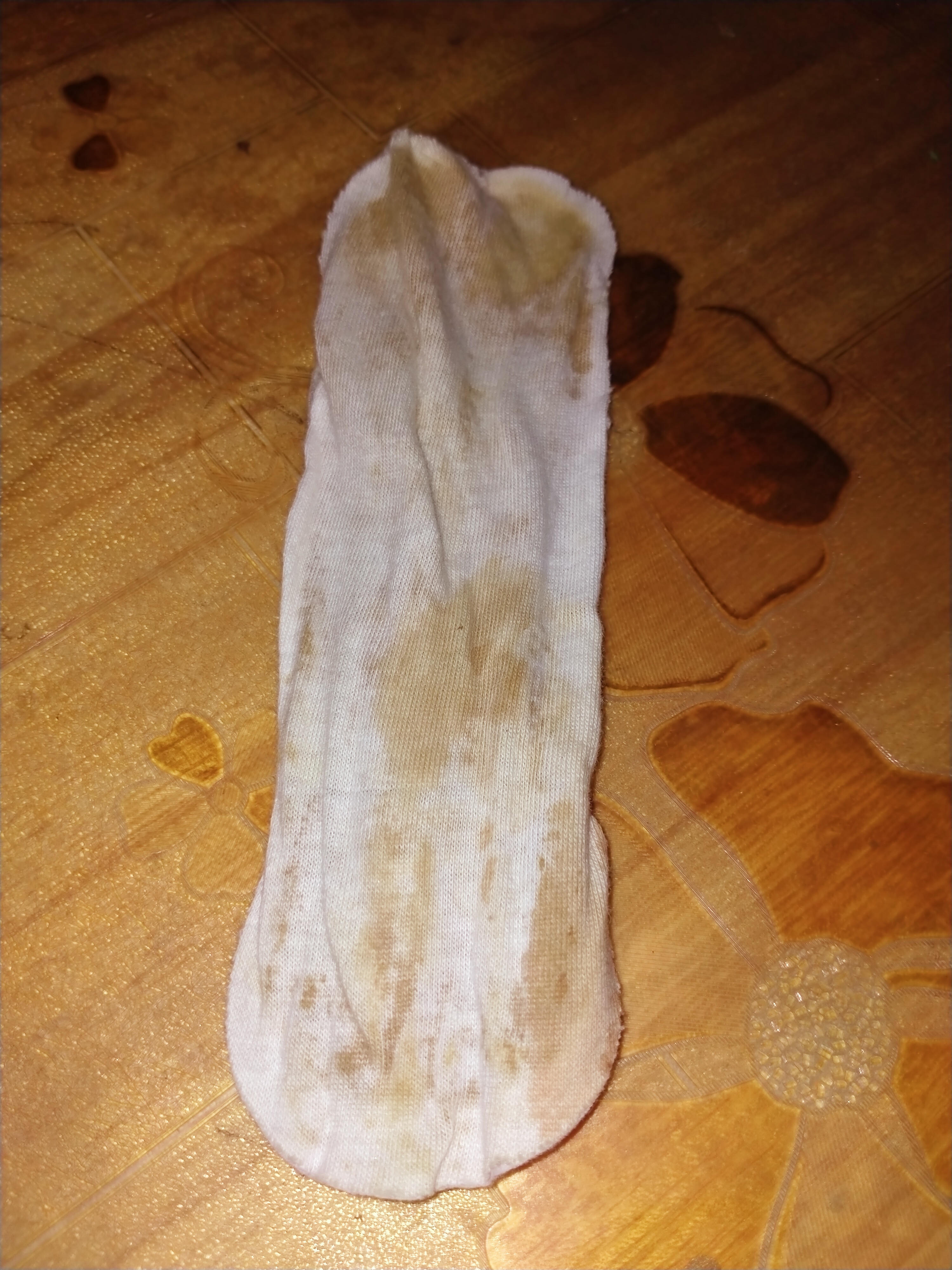 中有不少人存在误区,觉得妇科疾病是已婚女性的专属,只有经历过生产