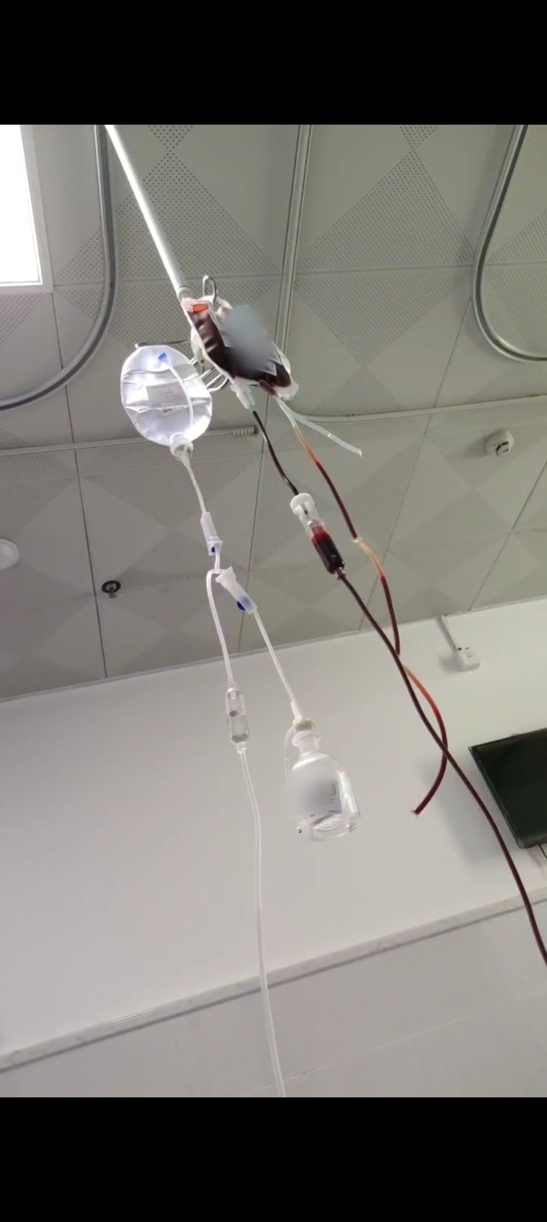 打吊瓶回血打针血液回流图片吊血针夜晚的医院图片 实拍输血躺了输