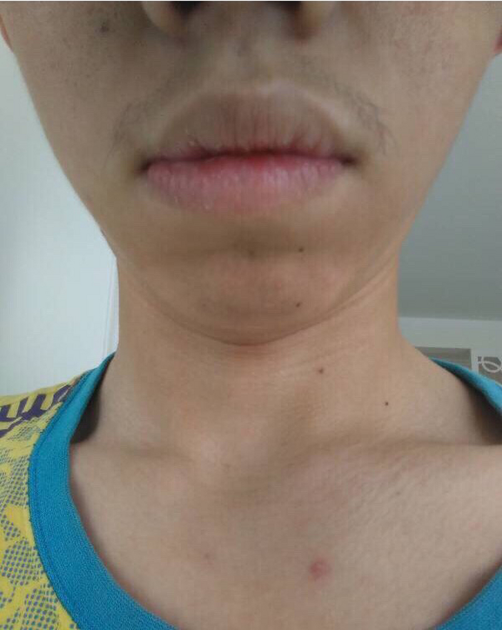 面相中晚年孤独 为什么吹火嘴晚年孤单?