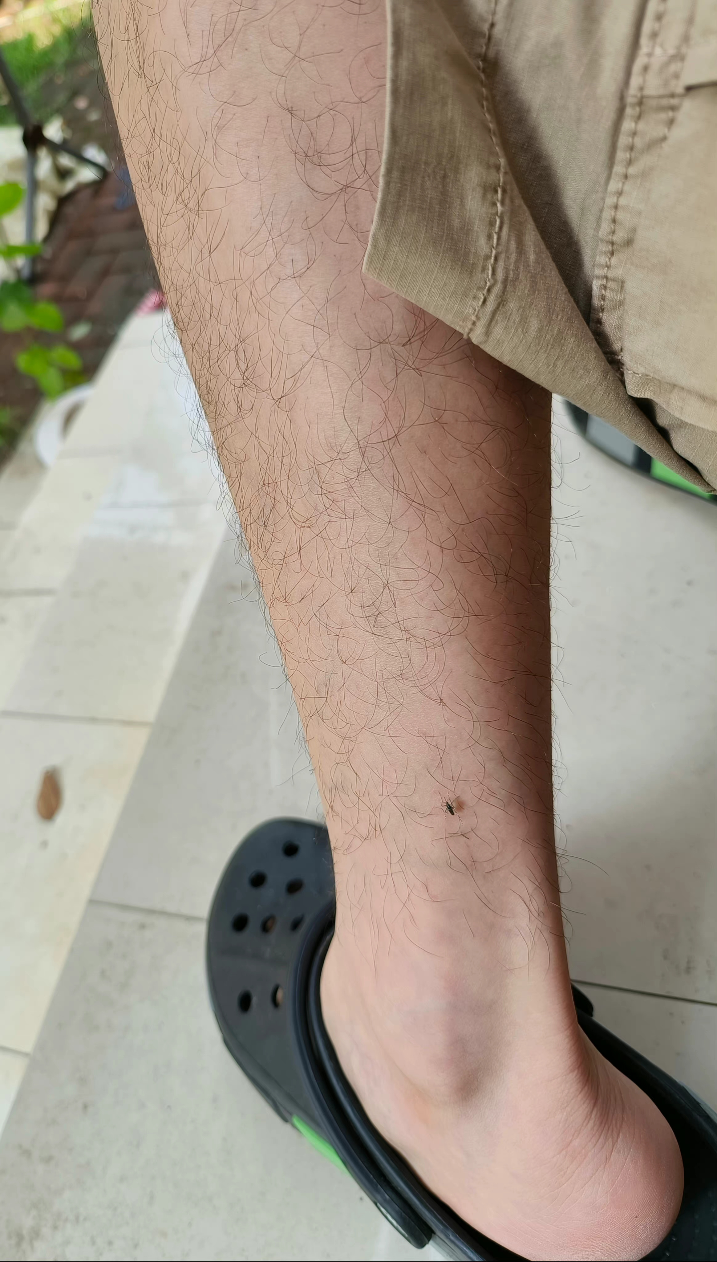 一条大力金刚腿,奇怪,为什么腿上的毛不会脱落?也不会变白?