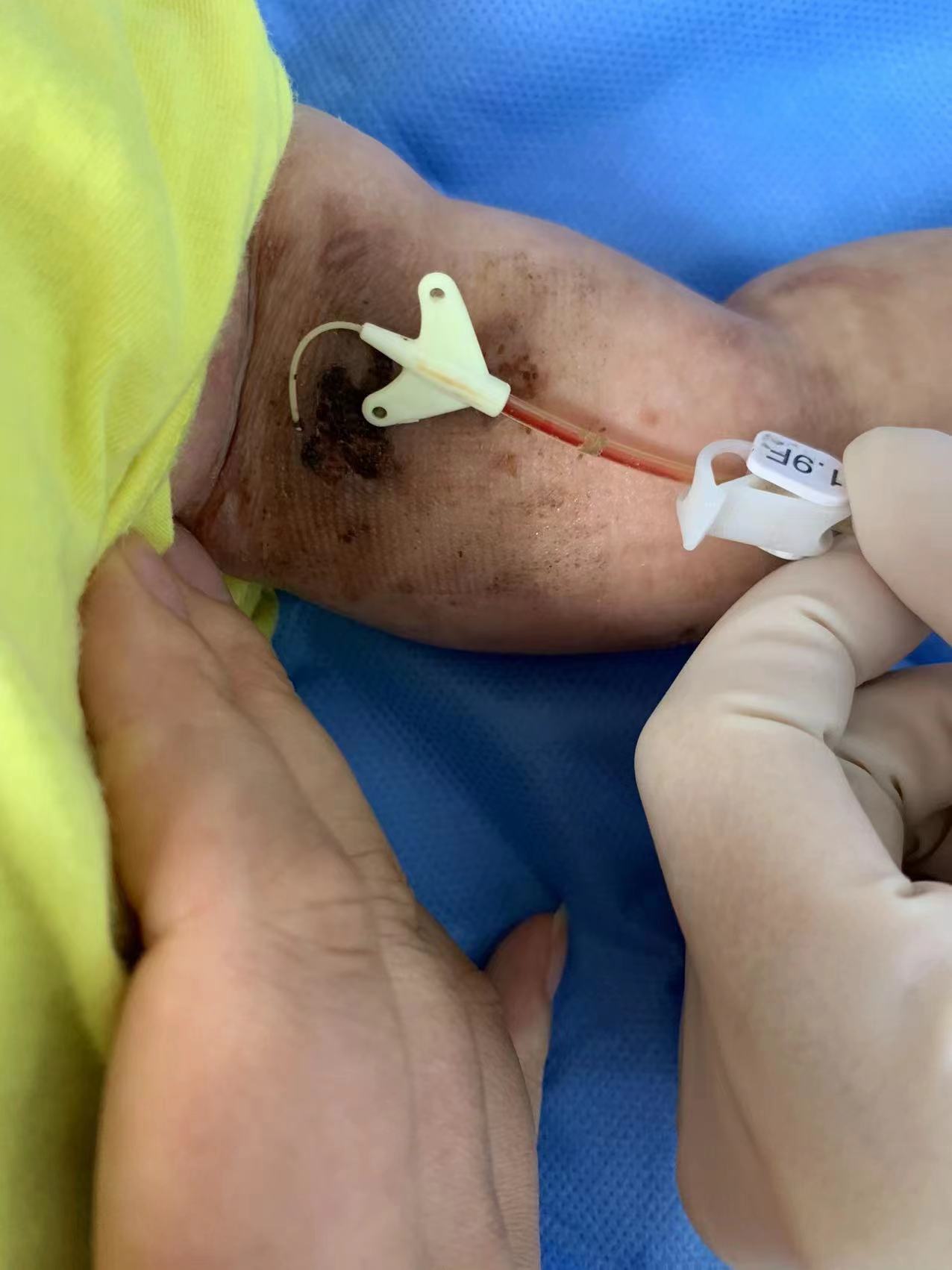 我们会好的对吧,我们会有很多时间的对吧,是我们不