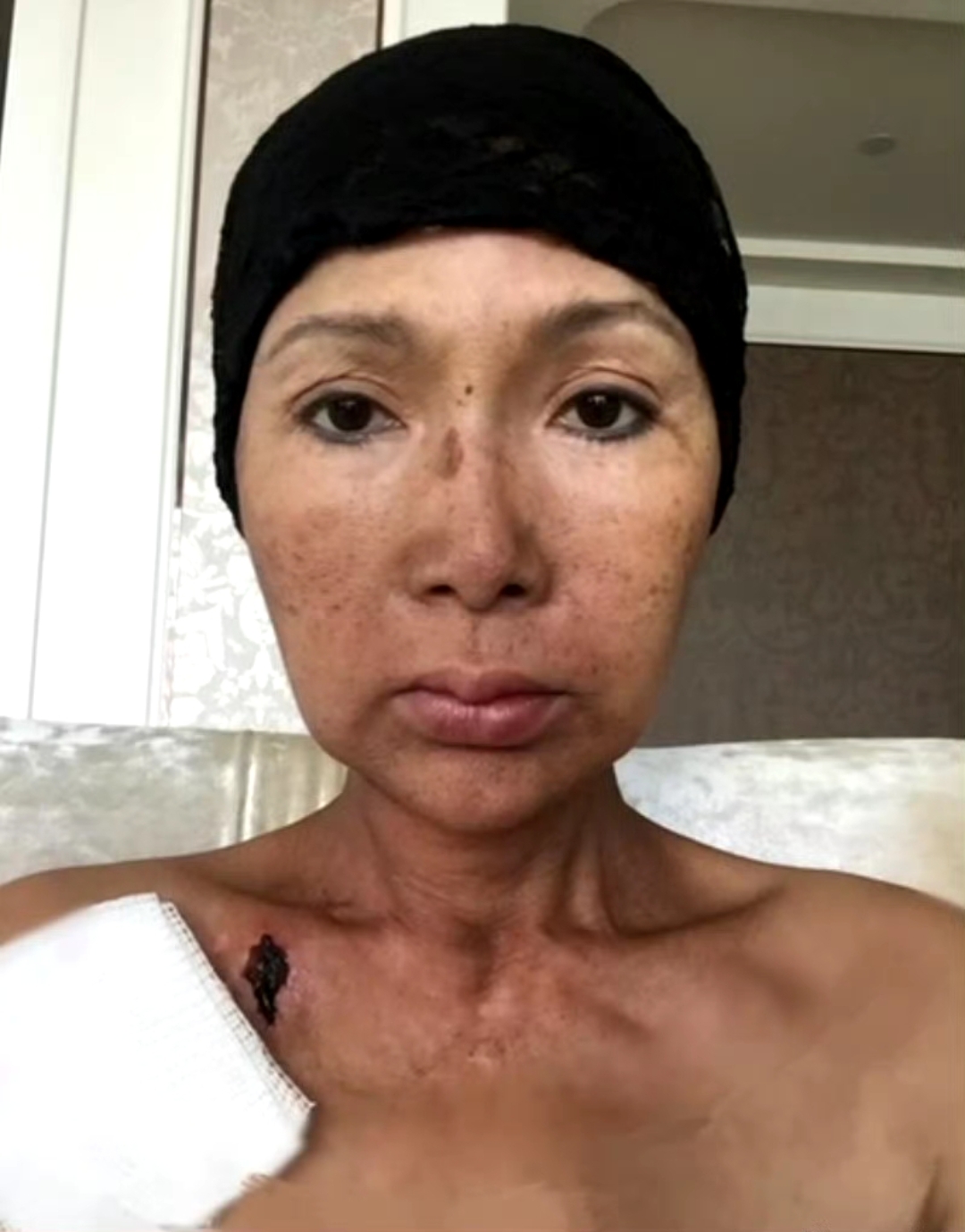 歌手张咪po出两张对比照 第一张是自己五年前,在放化疗期间的照片,第