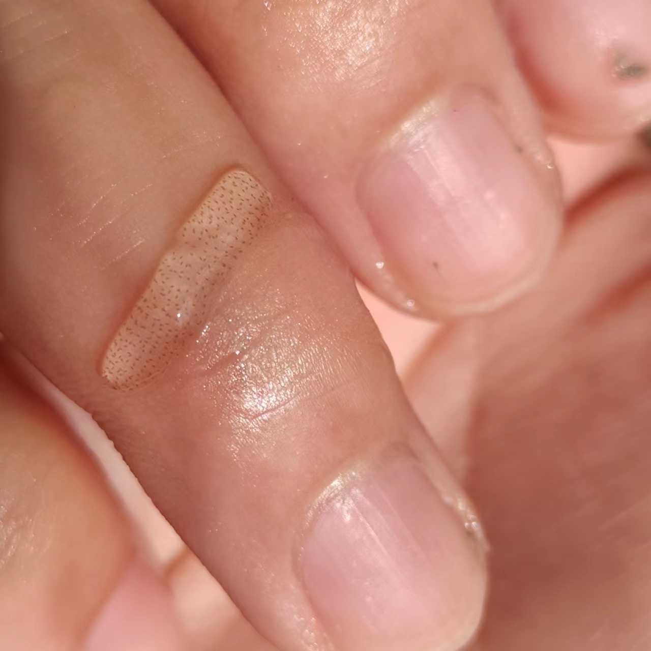 在线等 水里面出现像鼻涕虫一样 透明的虫子.虫卵一样的是什么?