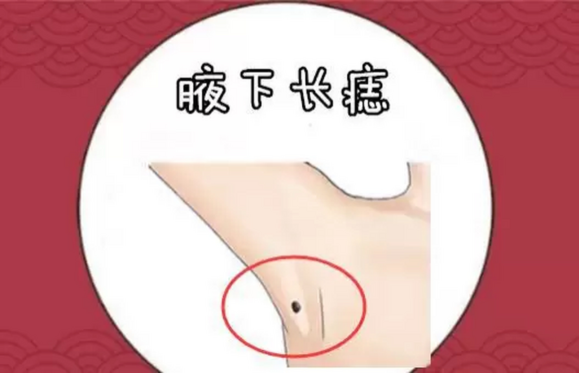 腋下长痣  在相学当中,若是在腋下的位置长有吉痣,往往会被称之为"金