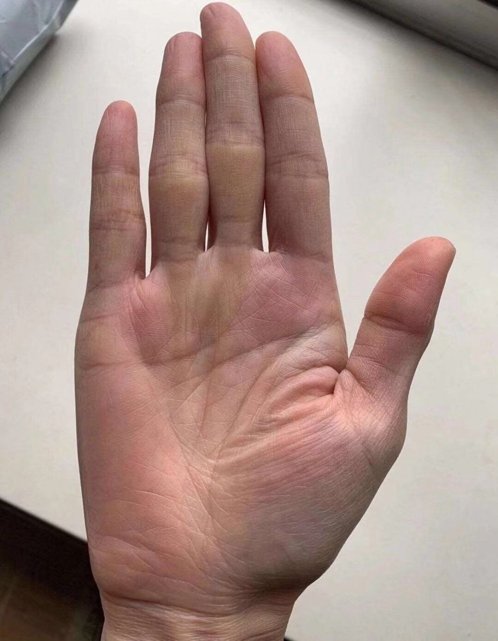 这位女命主的手相,感情线开端呈羽毛状,比较散乱,说明早期身边不缺人