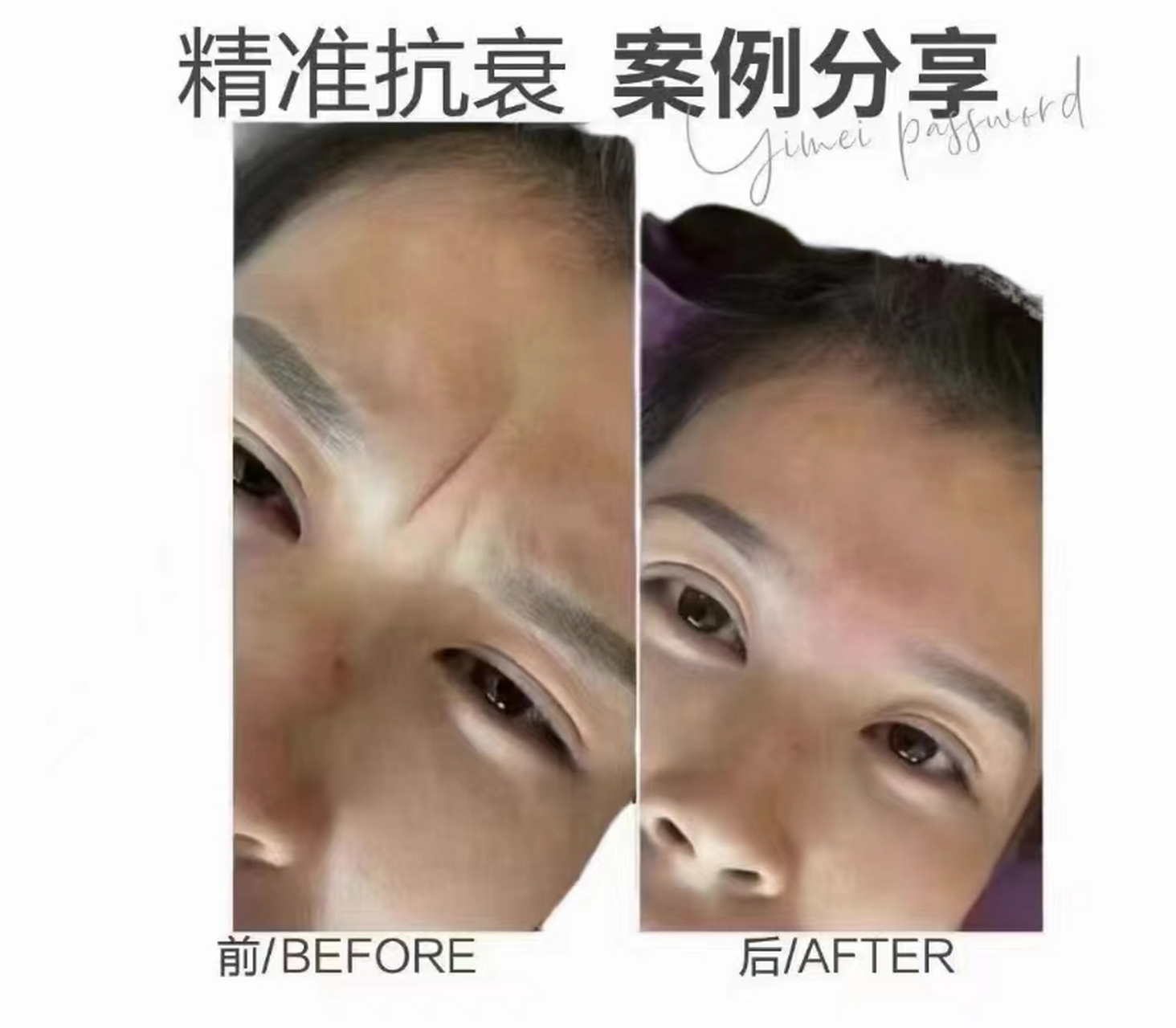 川字纹:又叫"斩子剑"  96风水学说讲69挡子女运势 96还会影响