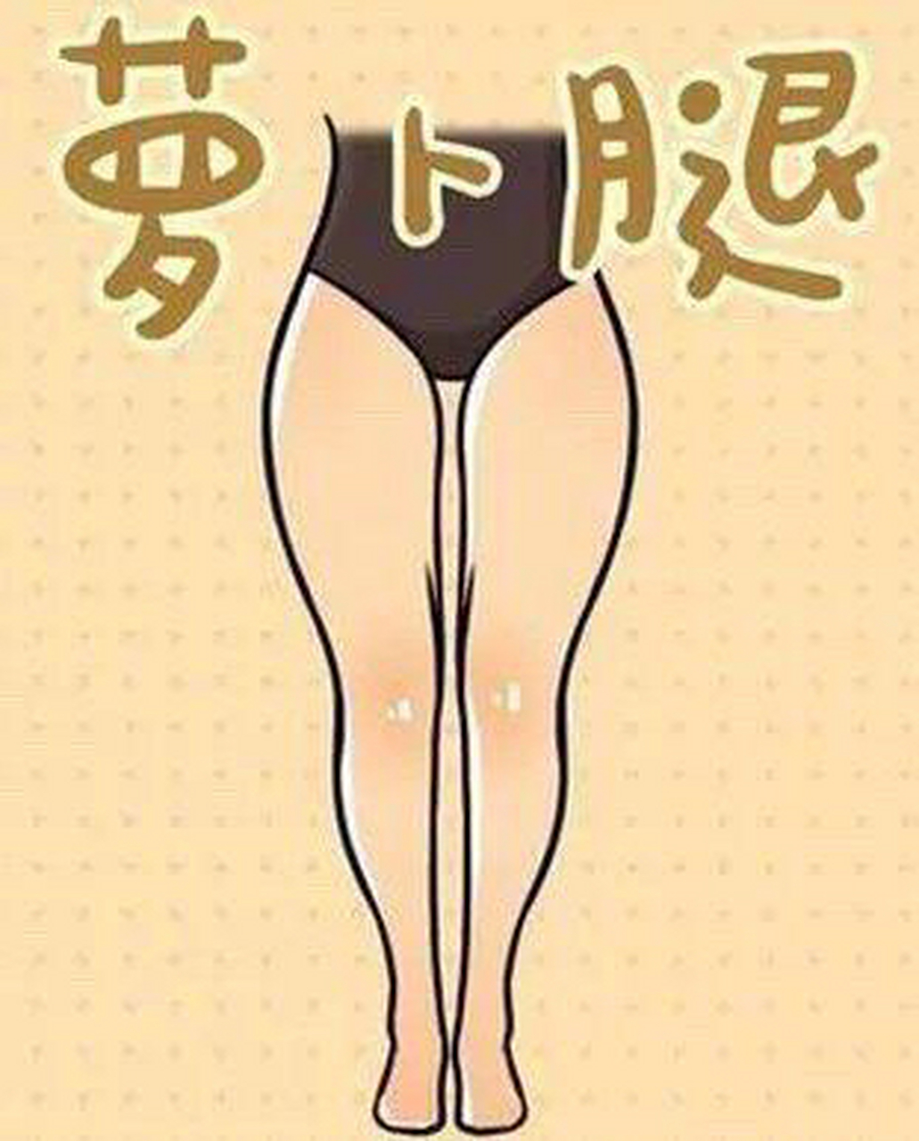 萝卜腿,  所谓的"萝卜腿"指的是脚脖子非常细,但是小腿的腿肚子却比较