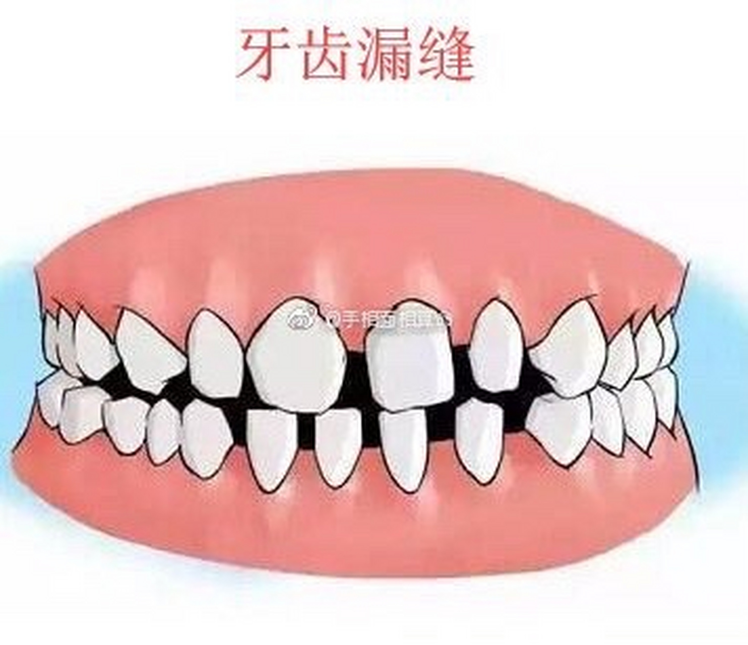 手相面相算命[超话]#来看看,牙齿上的面相格局你了解吗?