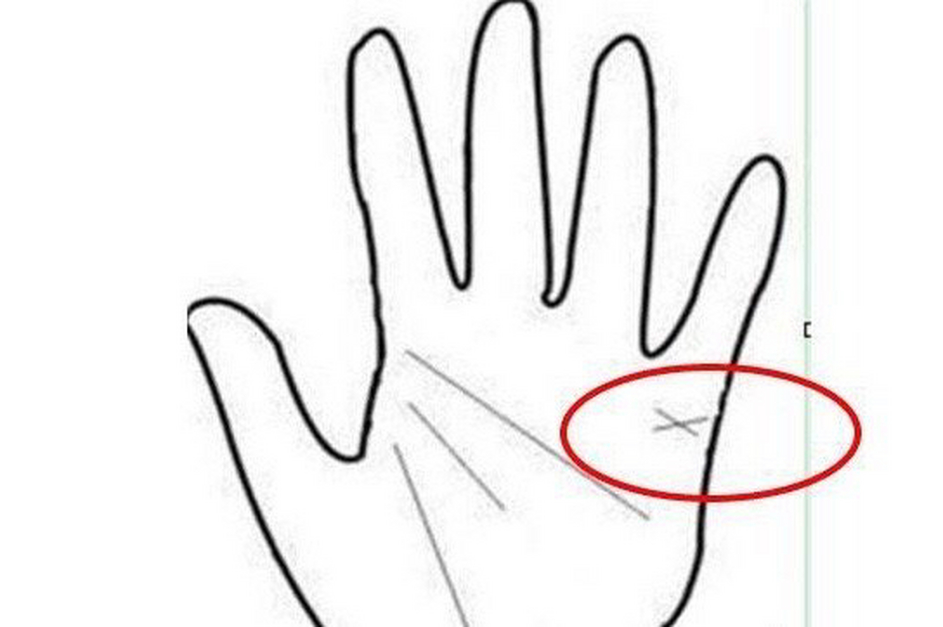 手相算命,  第一种,小拇指下方有一个x横纹  不但会离婚,而且婚姻上会