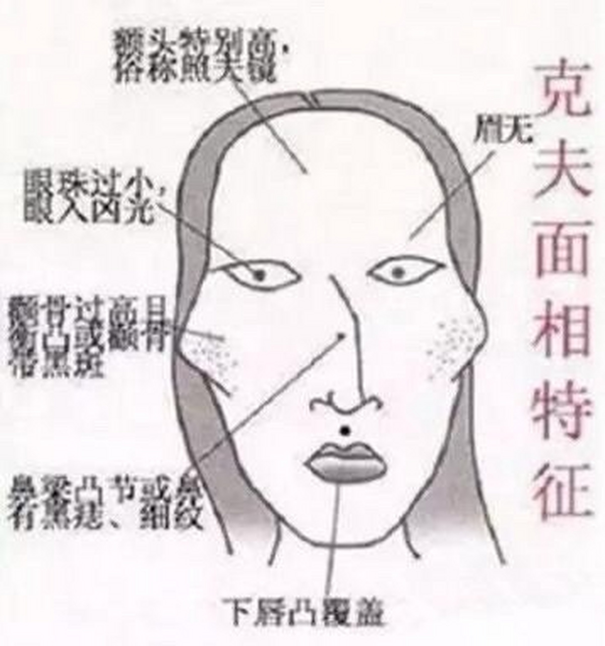 【颧骨外凸 奸门凹陷】 颧骨外凸 奸门凹陷,婚姻不顺的面相.