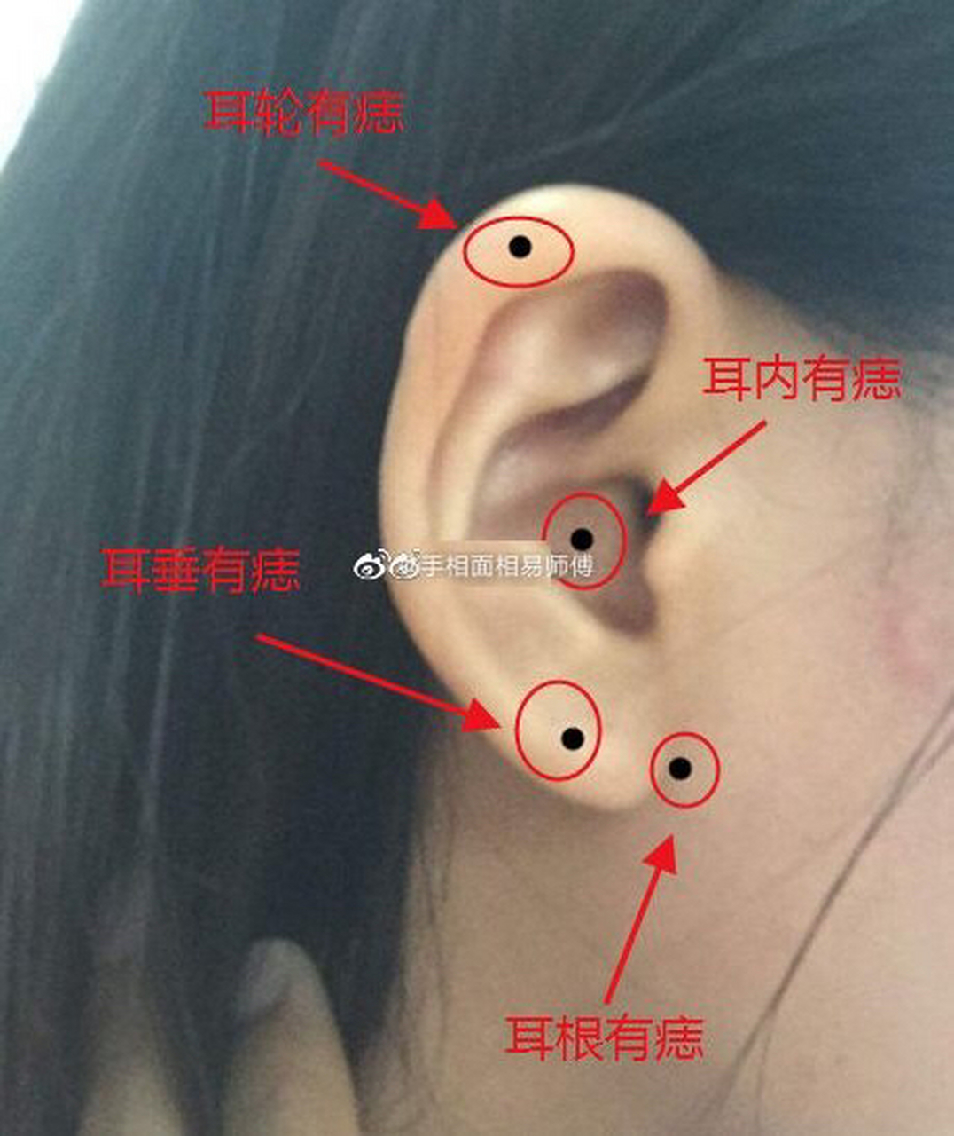 有人为了穿耳环,把痣打调了,结果财也露了.