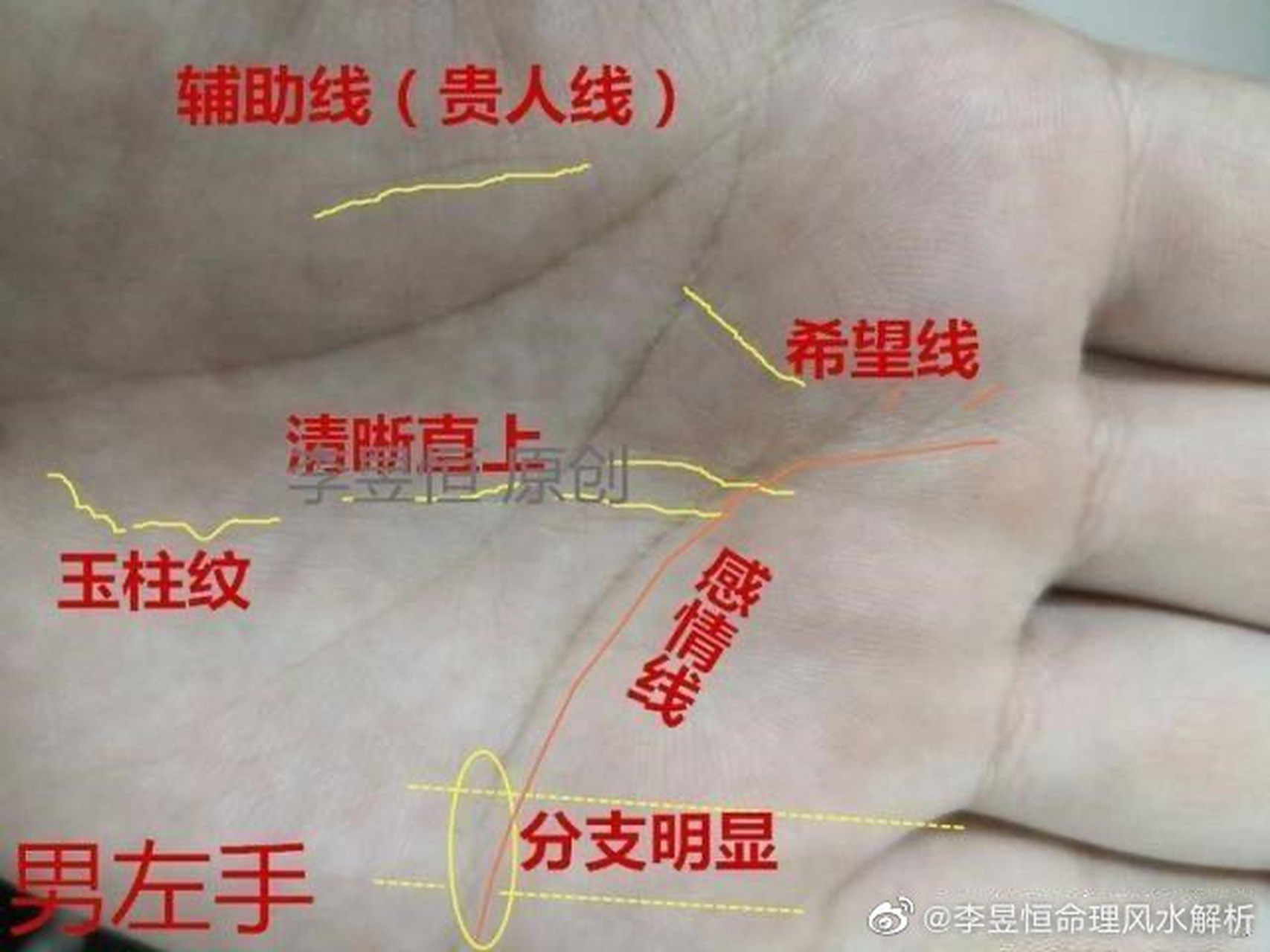 手相中的贵人线,是生命线的辅线,又称"姊妹线",是在生命线的内侧,紧靠