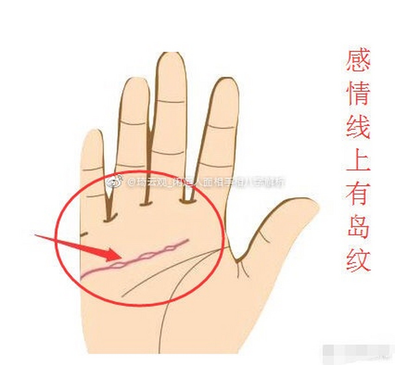 感情线上出现了岛纹,说明了什么?又该如何破解呢?