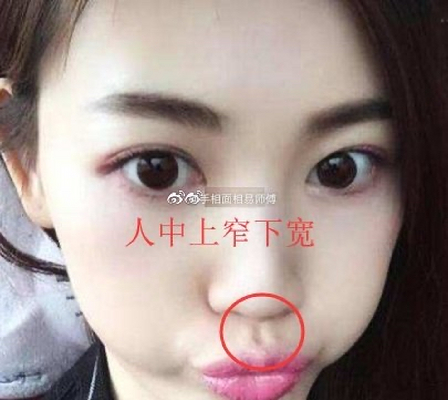 2,人中横纹 面相中的纹路多是不吉之相,尤其是人中有横纹,表示婚后