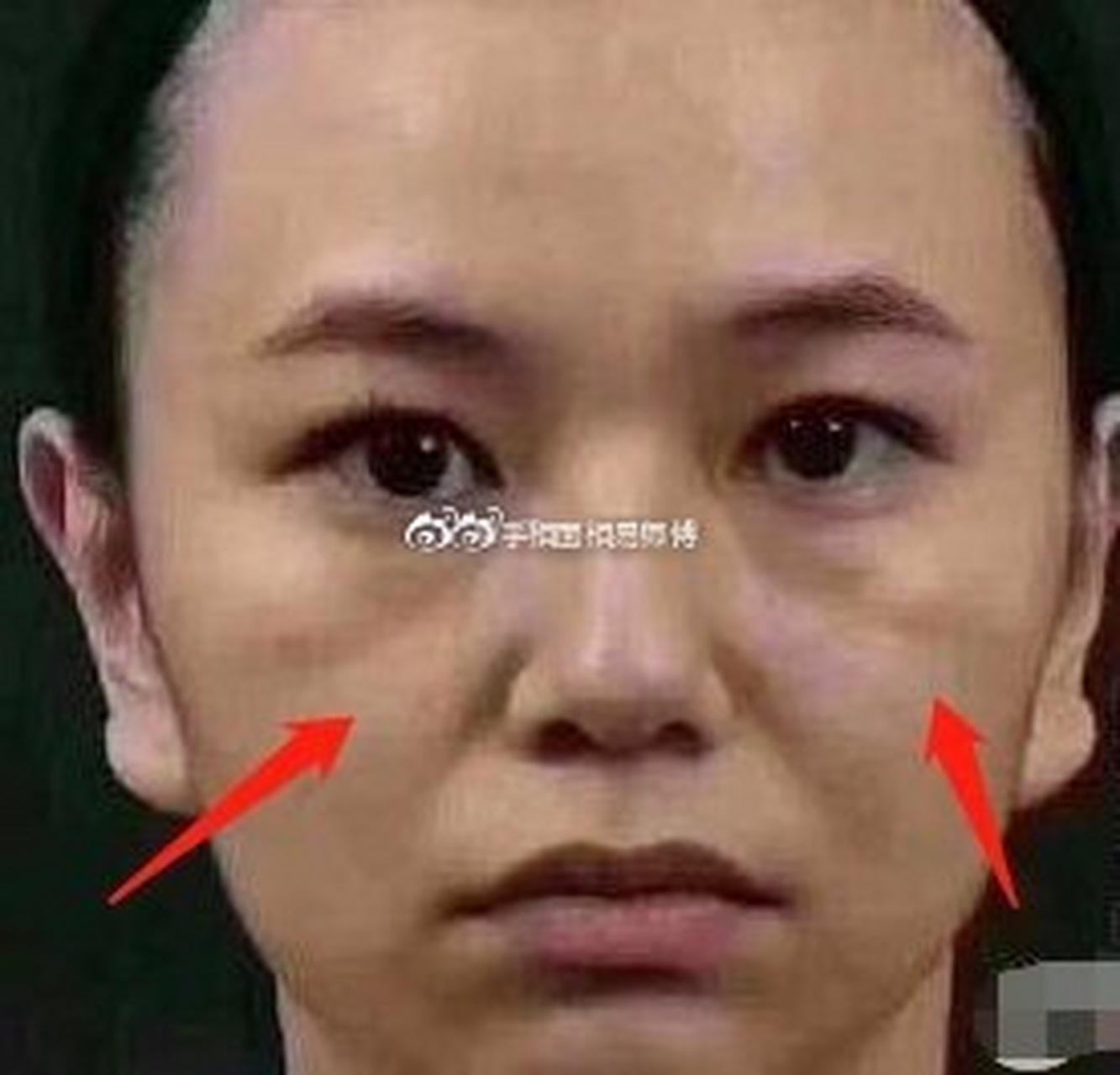 脸上如果有破颧纹,即使你在努力在拼命的赚钱,事业上却还是没有起色