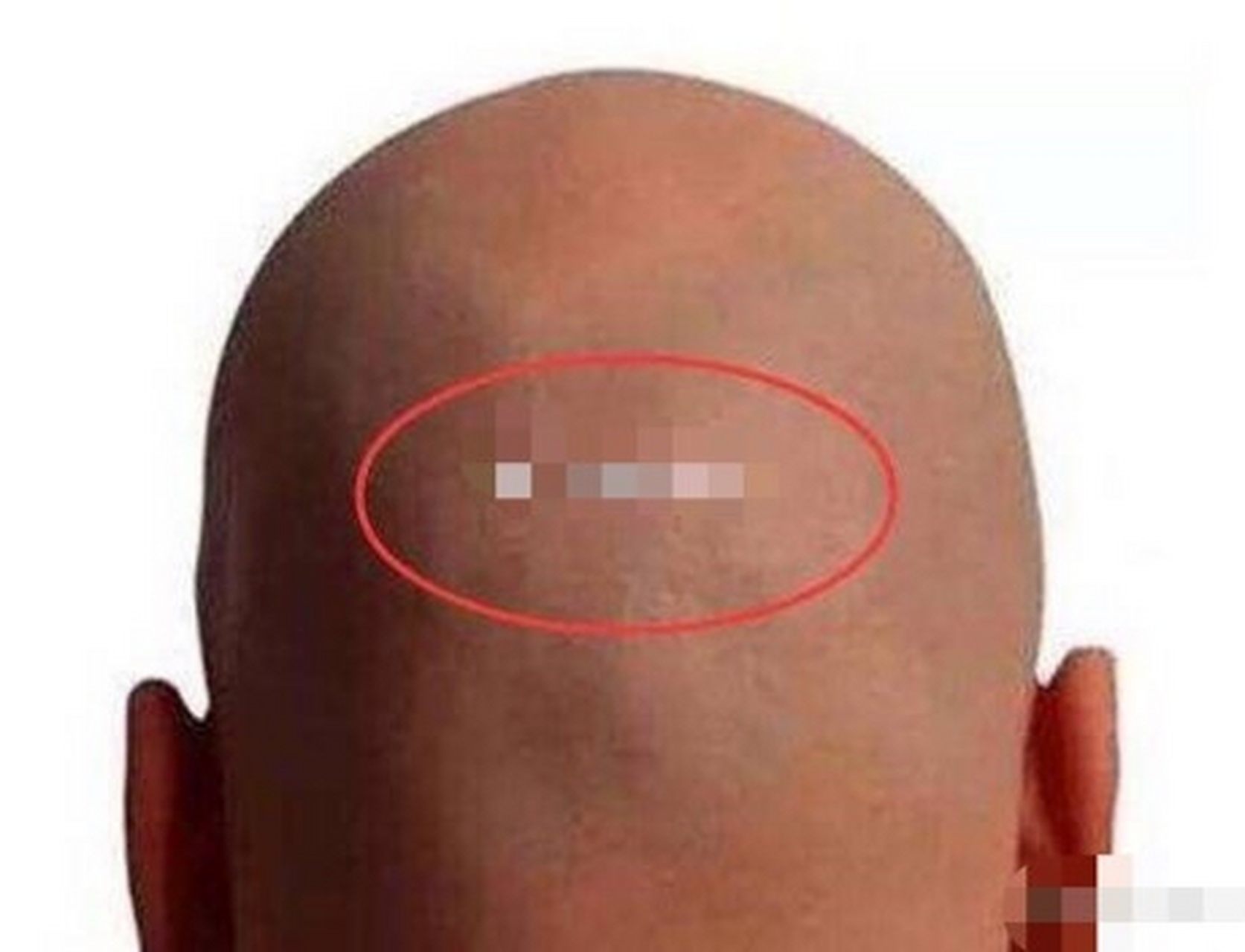 额高宽平福禄人,脑后连山晚运成,最怕额缺无好命,尖头瘦腰一世贫.