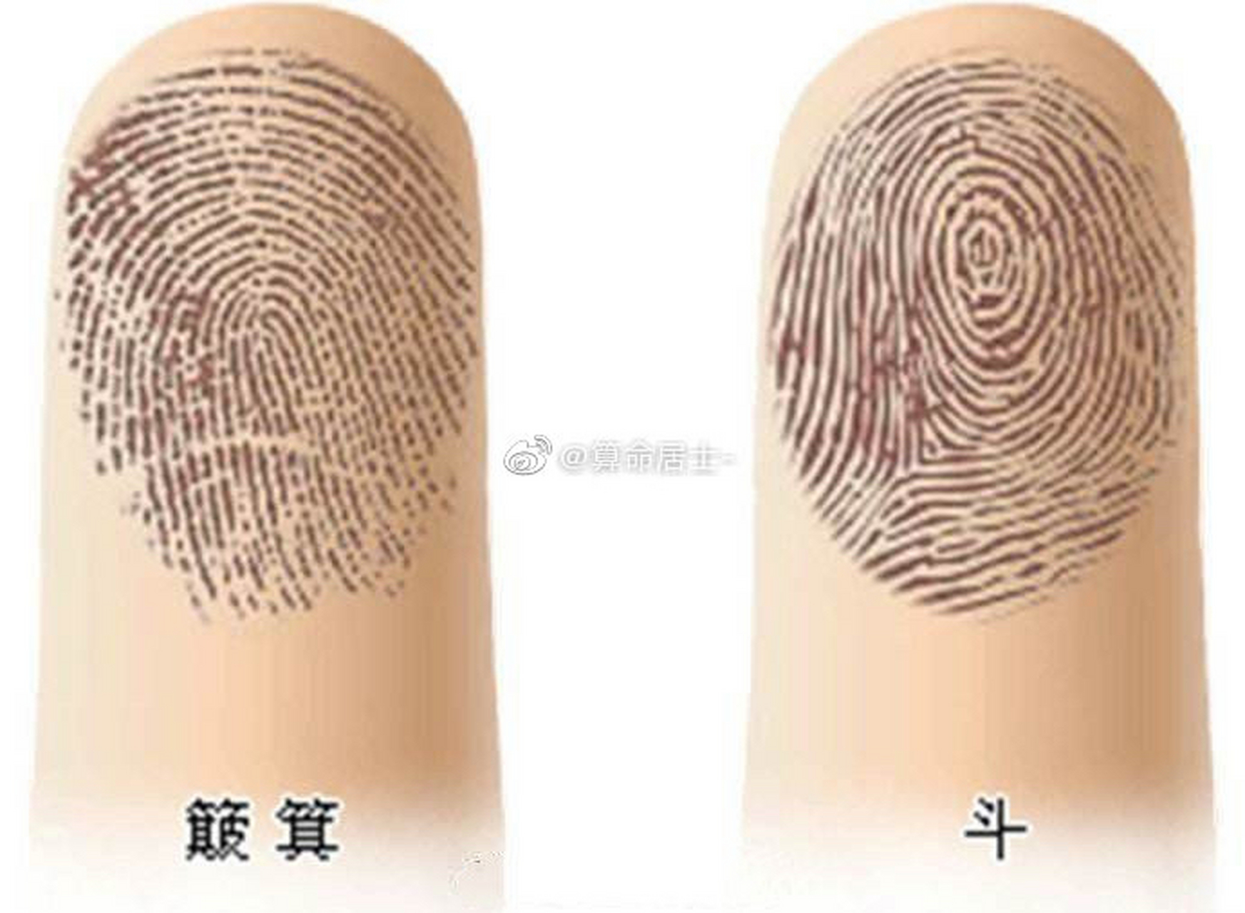 1,三个斗 十个手指中有三个斗的人往往做事情会比较努力,适合经商.