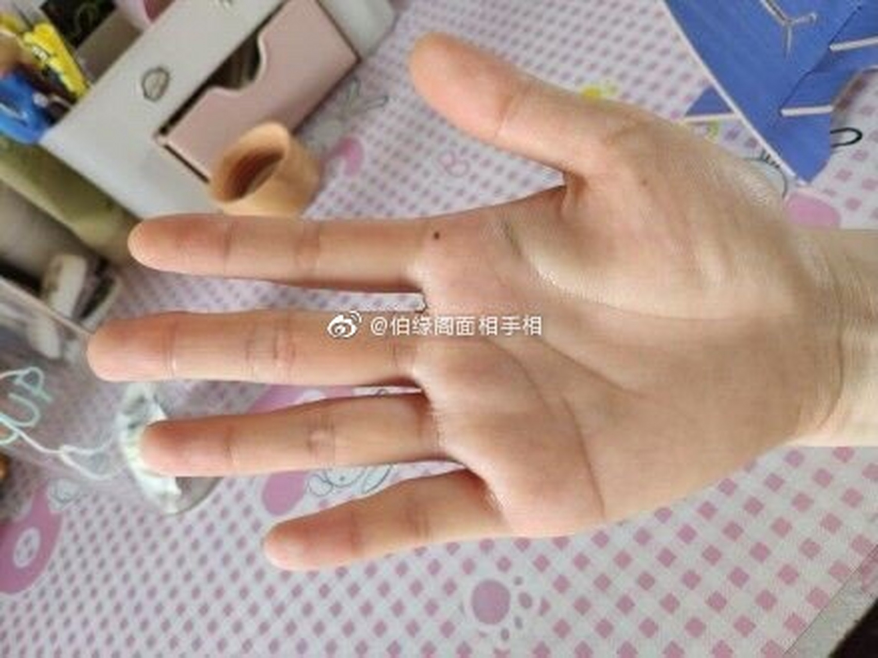 很少看到手掌有痣的缘主,恰巧就看到这个木星丘有痣的手掌,这颗痣代表