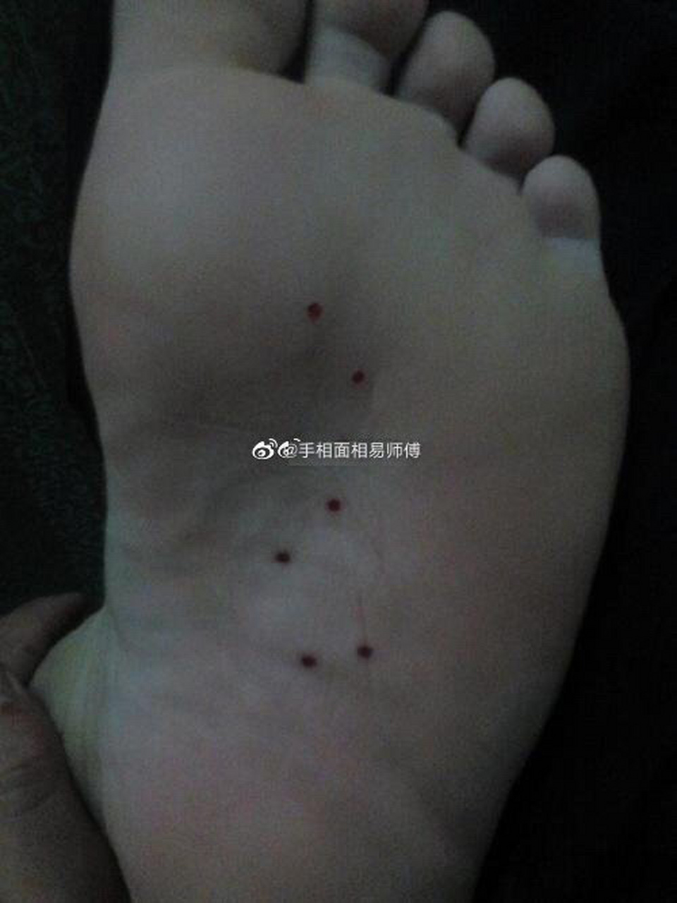 脸上的七星痣是一种少有的痣相,虽说在相学中主张面无善痣.