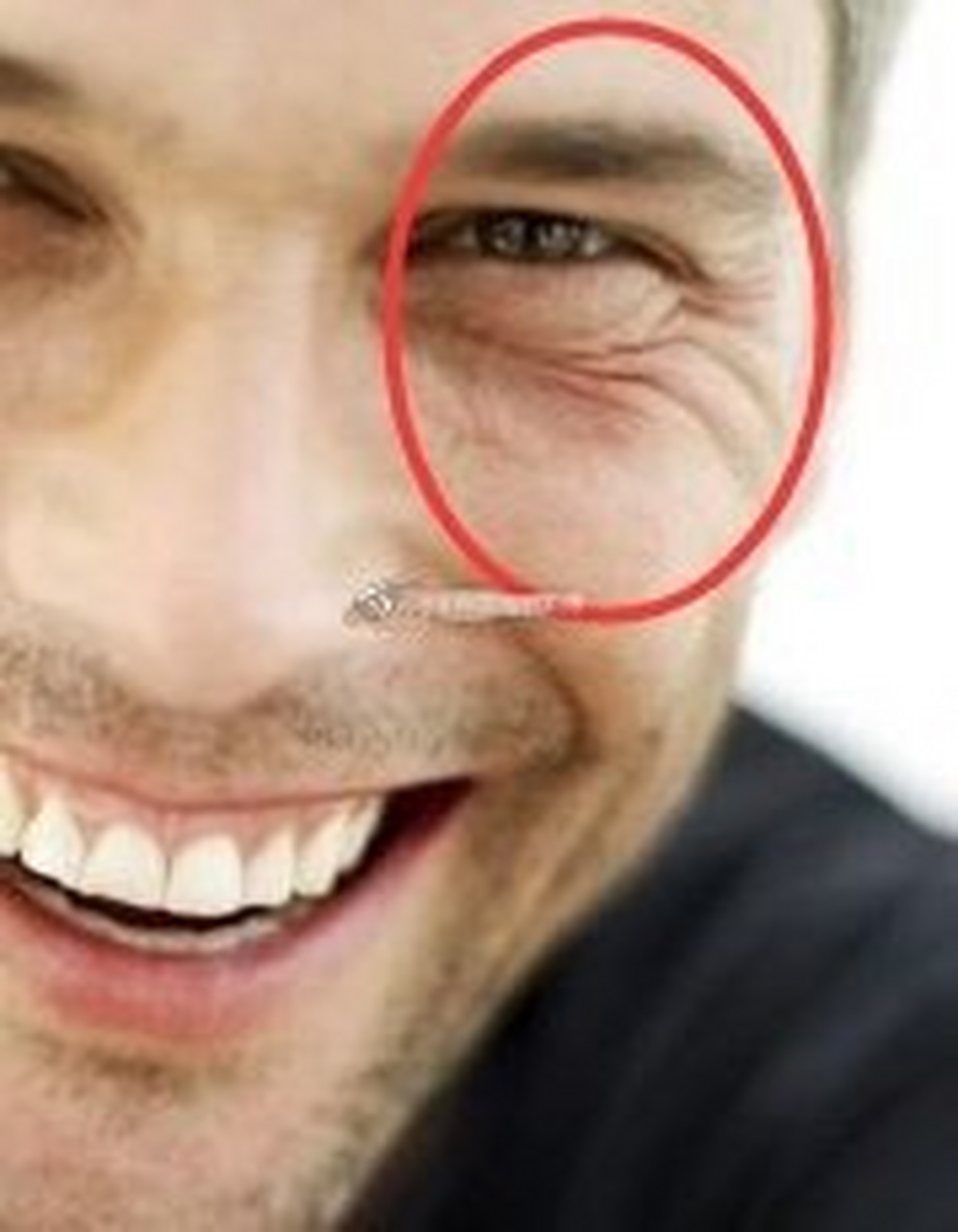 鱼尾纹开花的男人多好色,爱玩,很难收心,越乱越深则越严重.