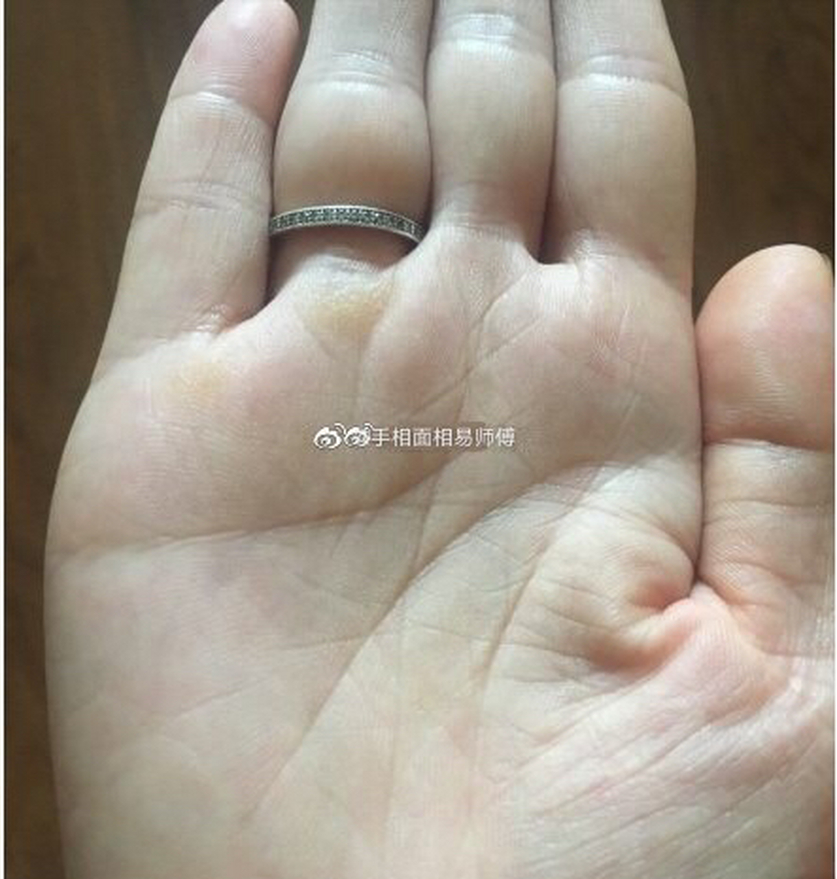 土星丘出现星纹,这说明其人聪明伶俐,对事物有很好的分析,有独到的