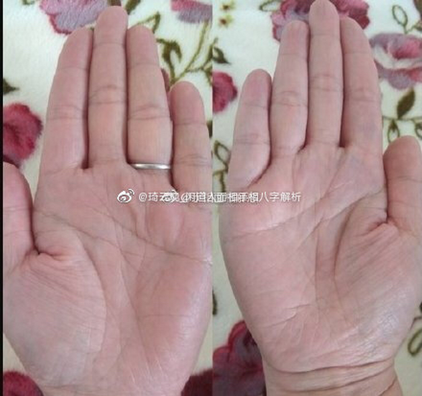 双手m型掌纹,一般有这样的纹路,事业上的潜力都是比较大的,但是你的掌