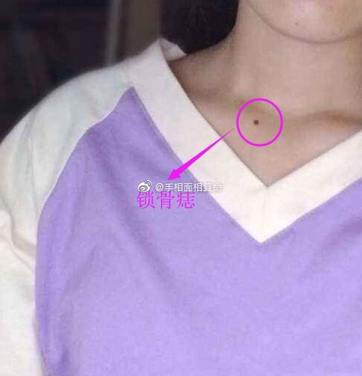 1,锁骨痣 这样的女人为人豁达,如果在加上锁骨明显.