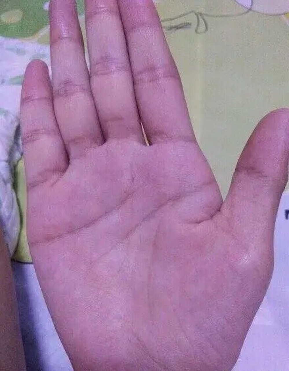 典型m掌纹,表明此人中年时期事业上有很好的成就,如若没有说明此人不