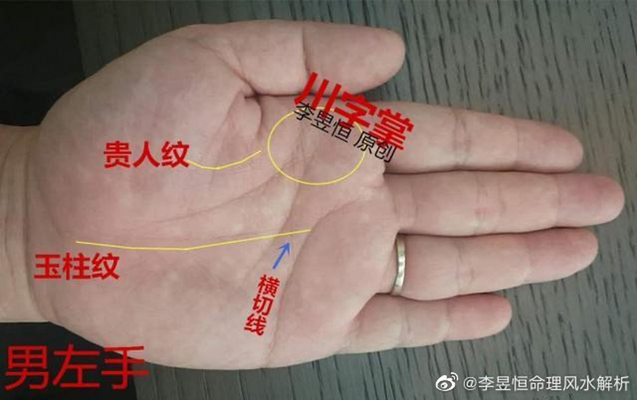 手相中的贵人线,是生命线的辅线,又称"姊妹线",是在生命线的内侧,紧靠