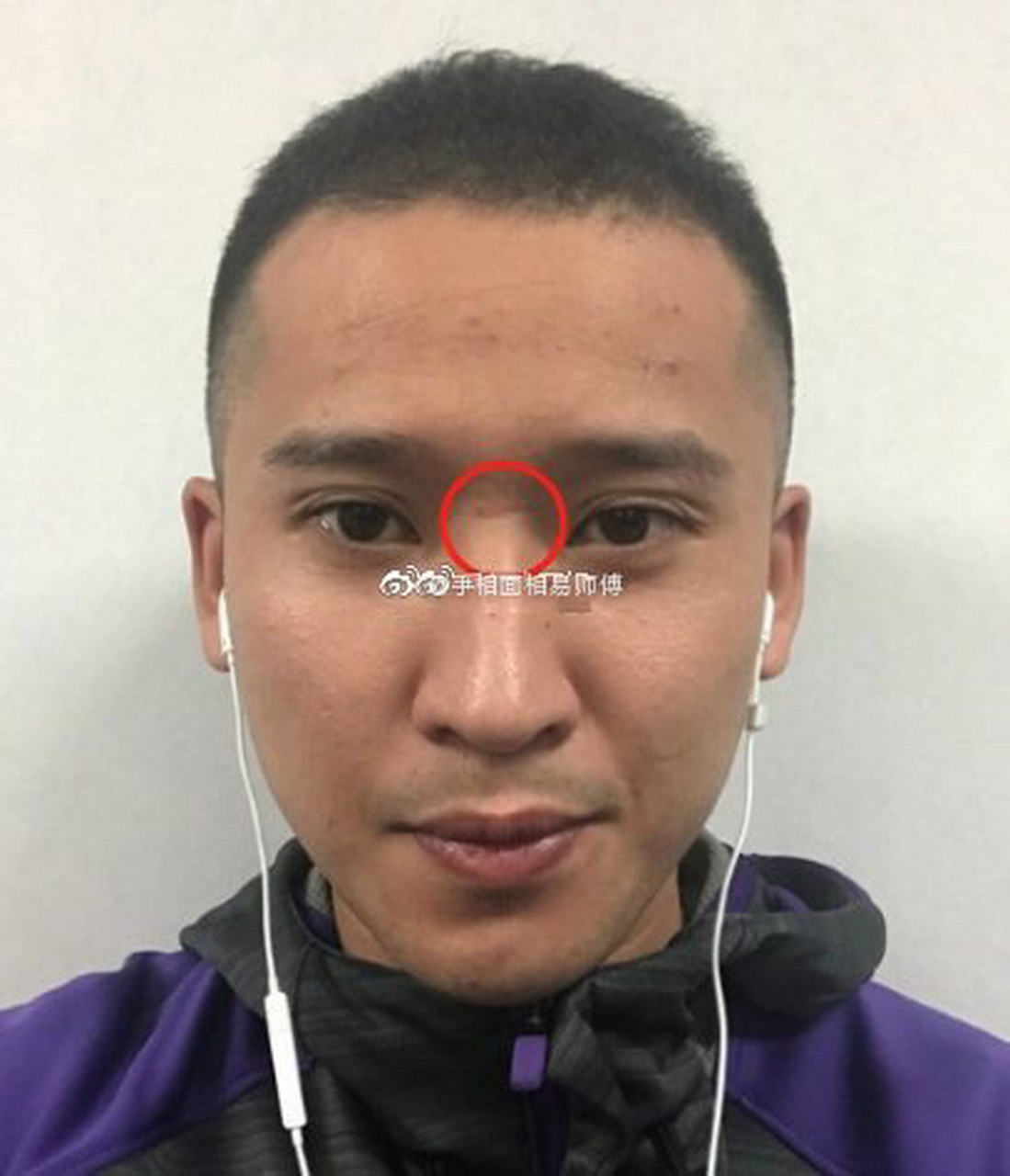 每日评论高互动缘主手面相分析(随缘抽取) 男人山根断,有横纹者,与第