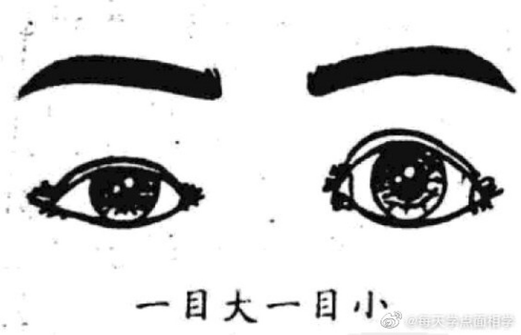 【一目大·一目小】眼睛很明显的大小不同,称为雌雄眼,这是夫妇意见不