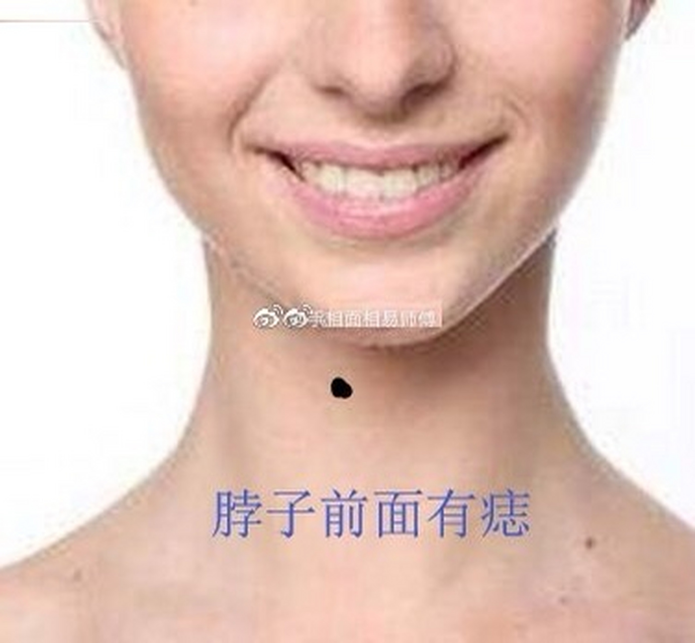 你的脖子上有痣吗?不妨看看寓意如何.