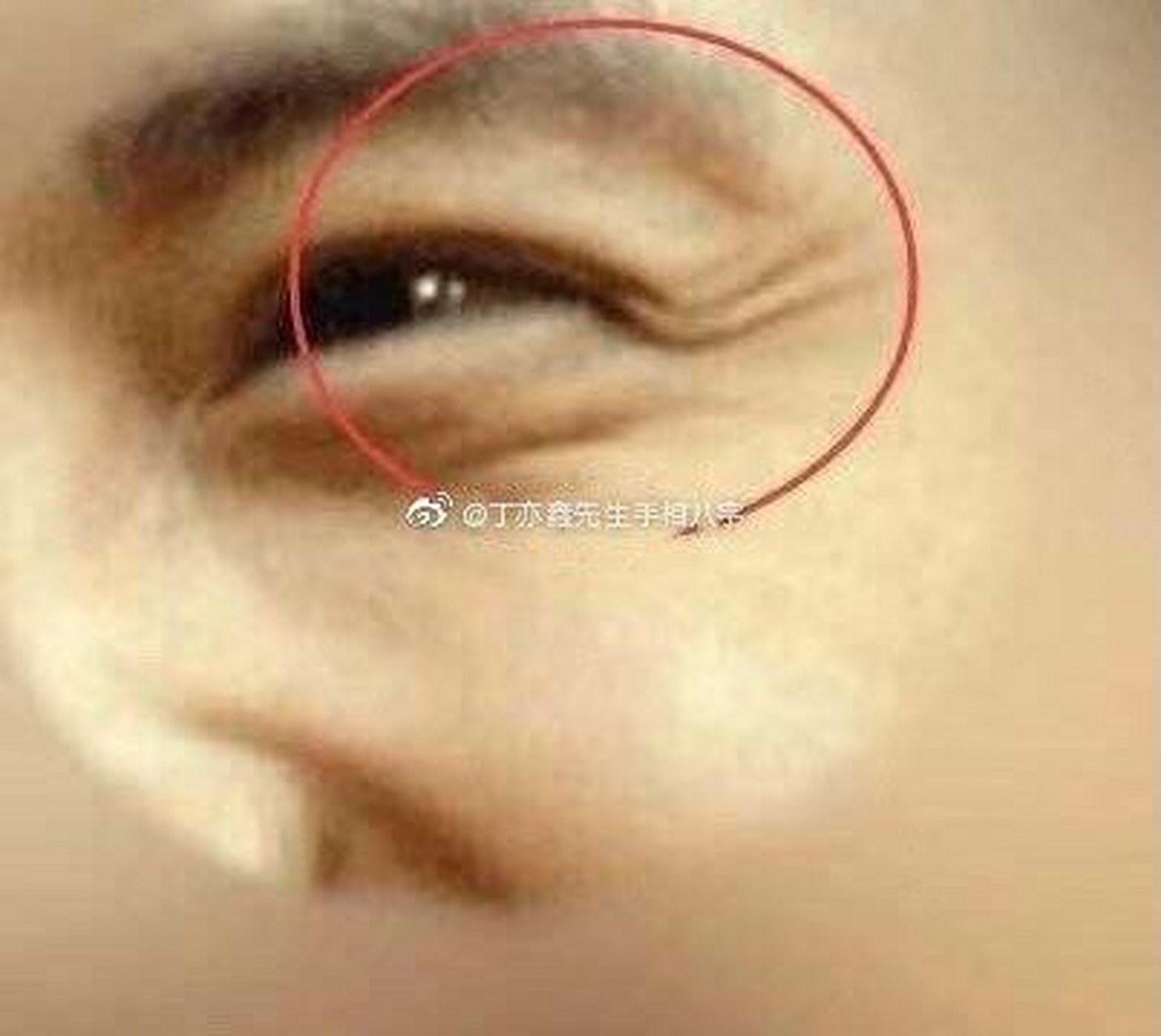 鱼尾纹朝下的人个性内向,常常被动,这样的人没有上进心,这样的渣男