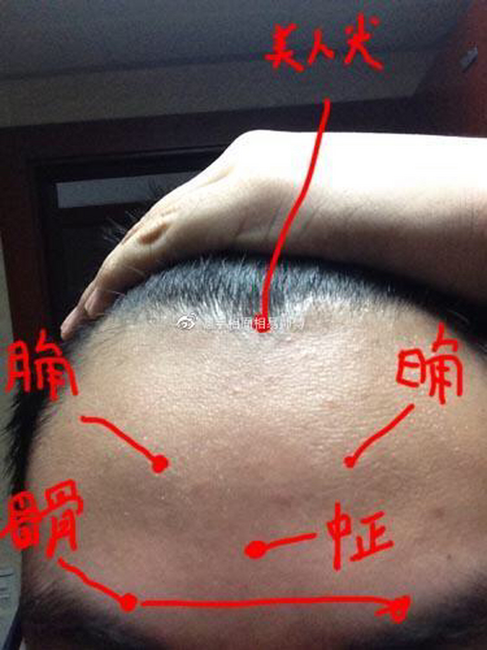额头两侧称父母宫,又名日月角,此处褒贬优劣,不仅关乎事业运势,也关乎