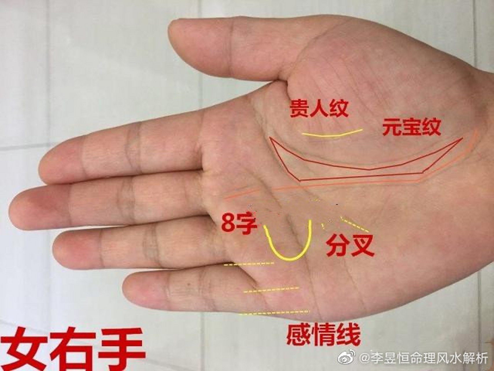 手相中的贵人线,是生命线的辅线,又称"姊妹线",是在生命线的内侧,紧靠