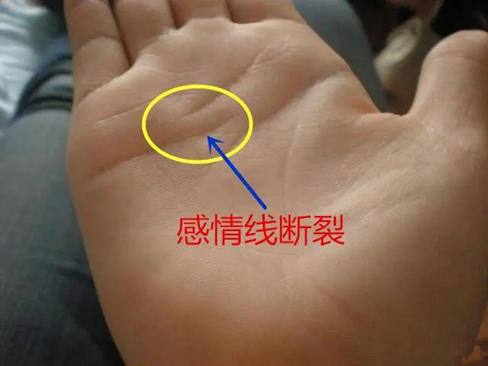 如果感情线在无名指和小指之间的空隙下断裂,然后又有一条线延伸到