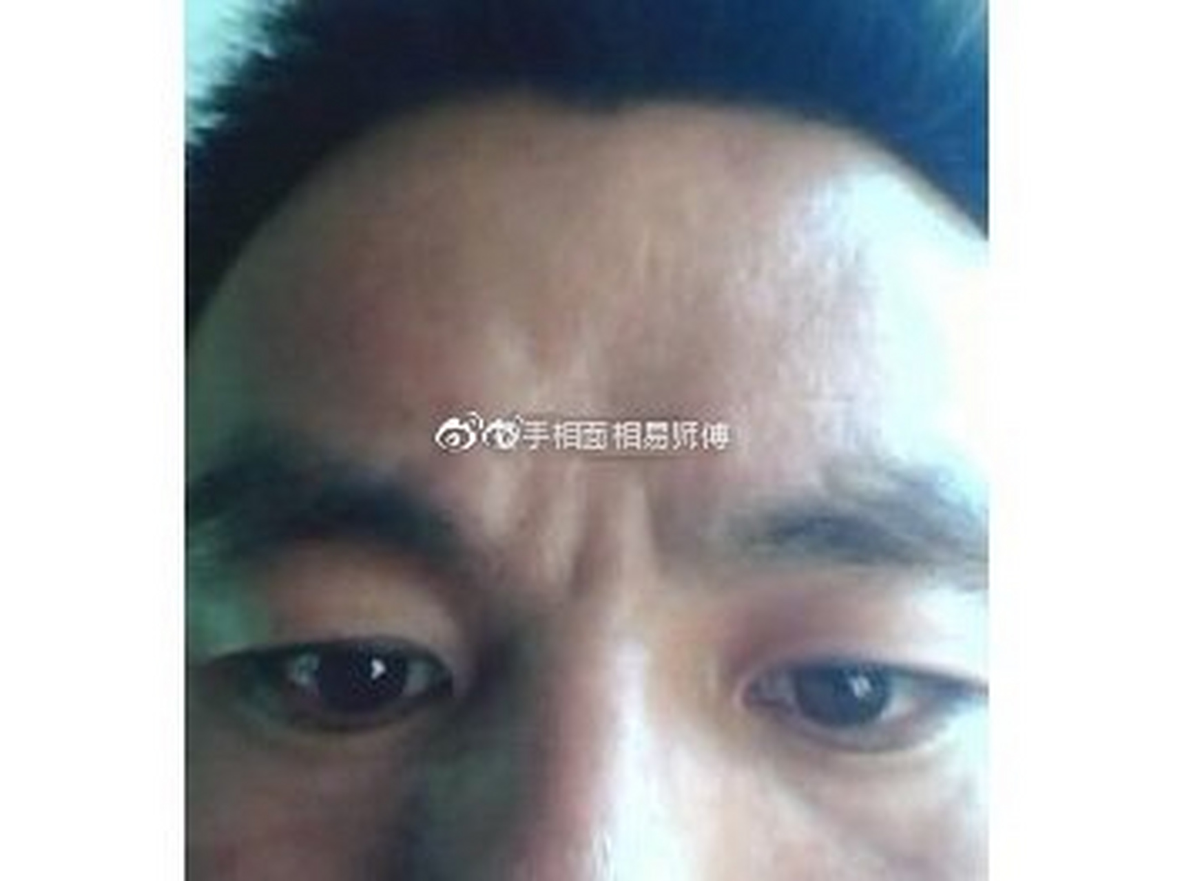 最不吉利的印堂面相  1,女子印堂过宽,为人单纯,容易被骗.
