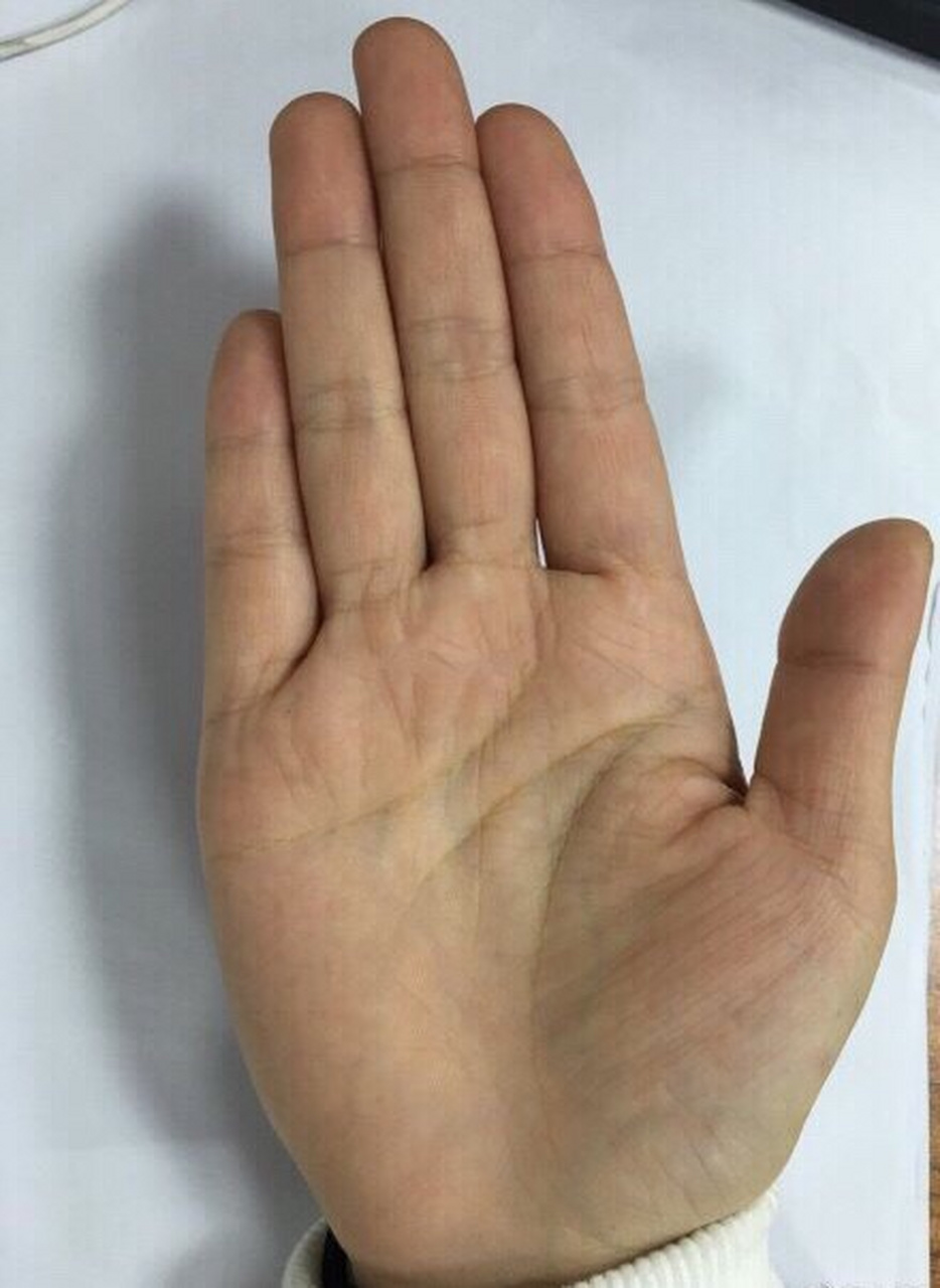 手为木型手,感情线延伸到食指与中指指缝中间,大拇指有夫子眼,性格较